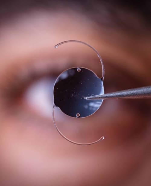 Photo,Of,Intra,Ocular,Lens,Iol,For,Treating,Cataract,Infront